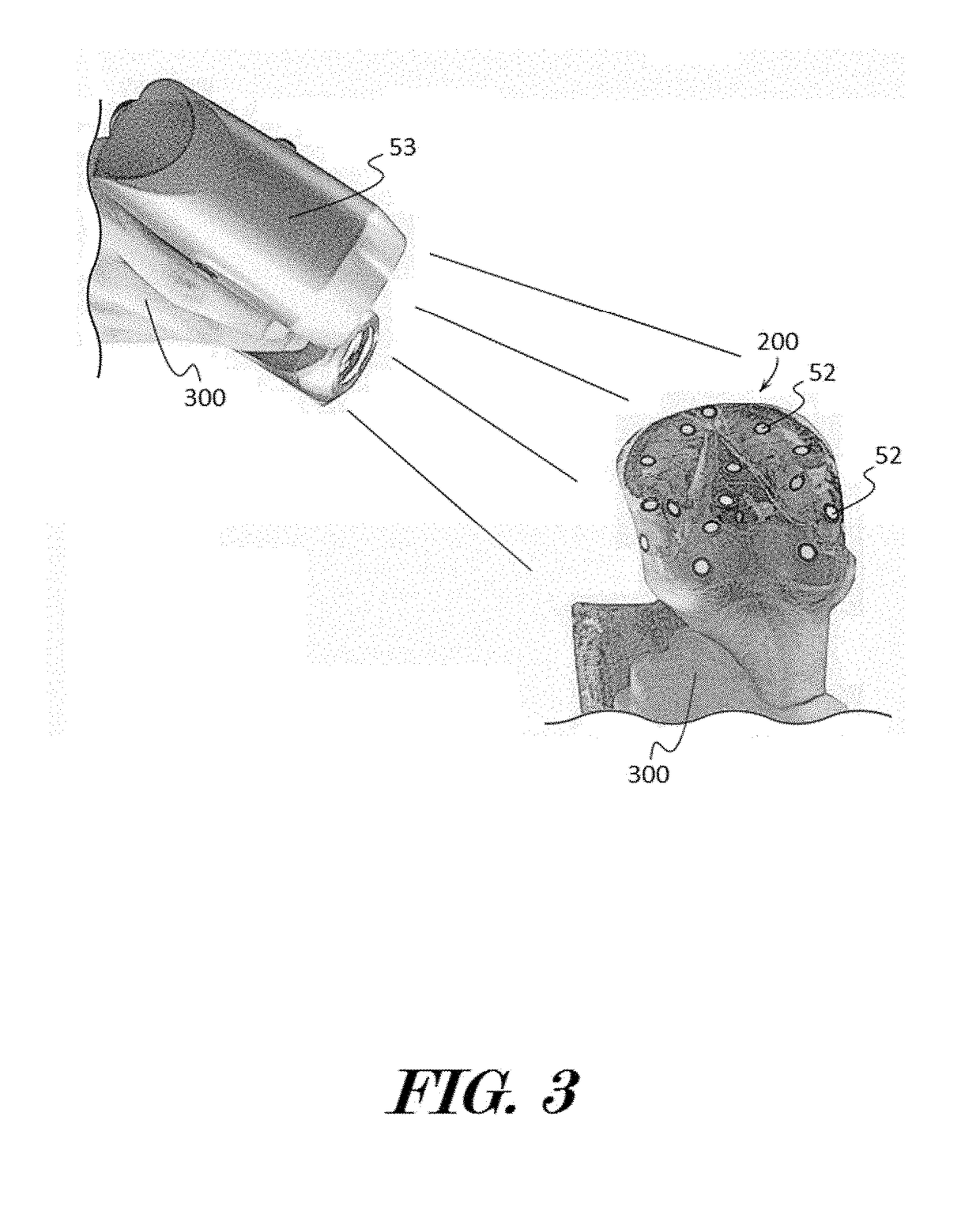 Customized Ungulate Foot Protection Devices and Related Assemblies and Methods