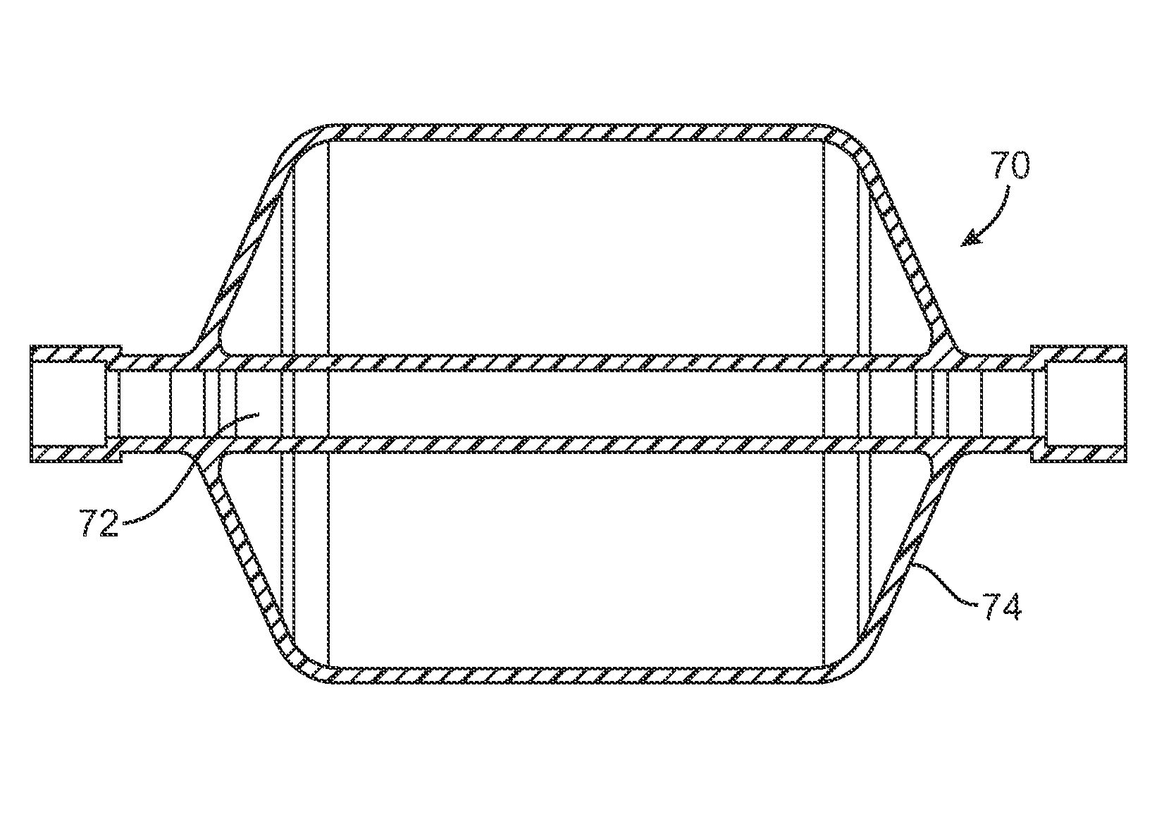 Methods and devices to induce controlled atelectasis and hypoxic pulmonary vasoconstriction