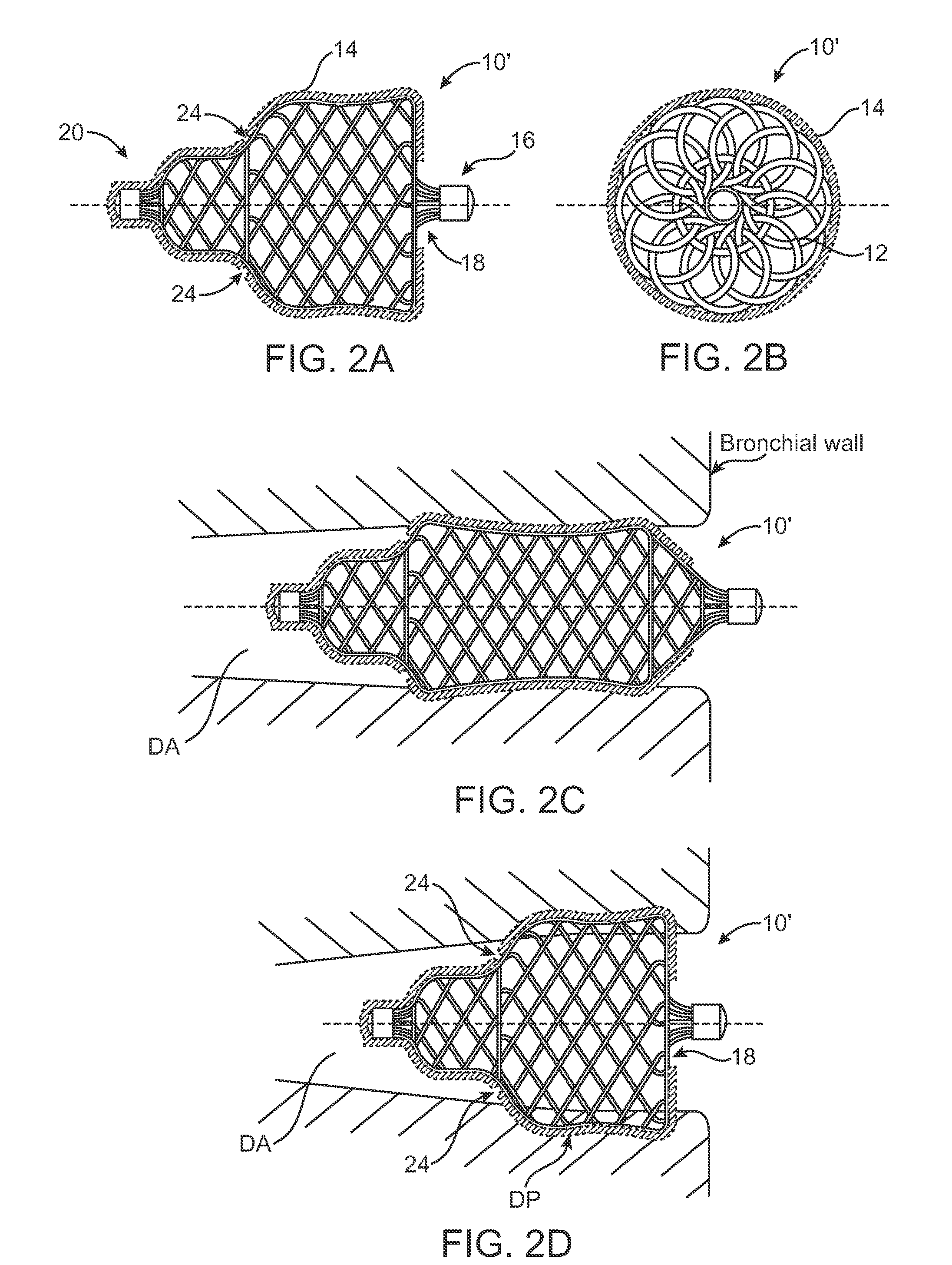 Methods and devices to induce controlled atelectasis and hypoxic pulmonary vasoconstriction