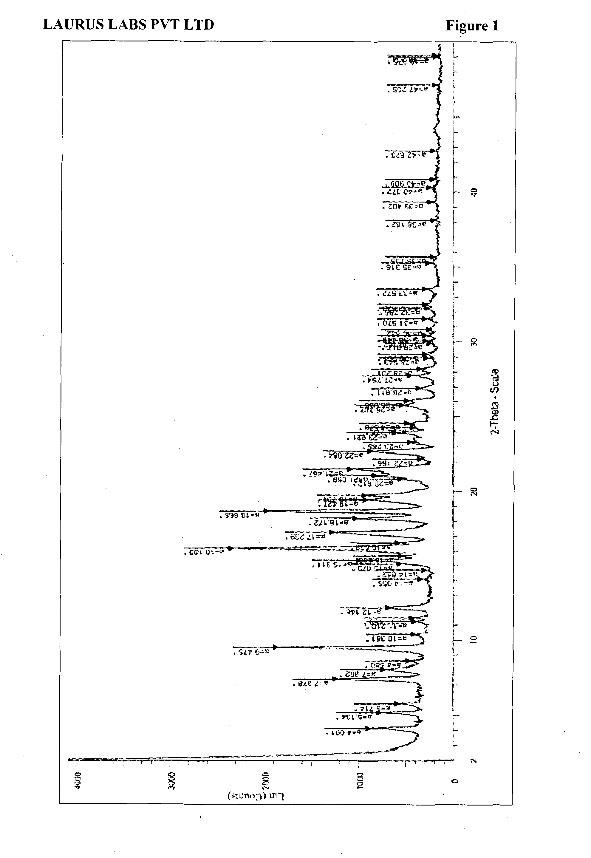 Process for preparation of montelukast sodium