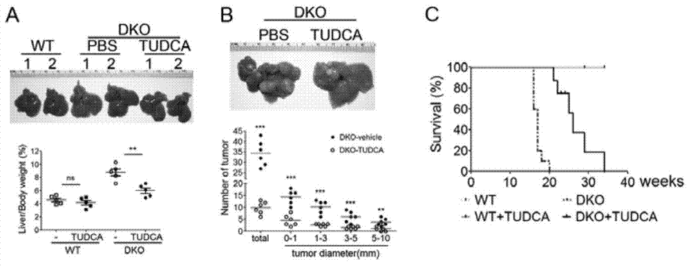 Pharmaceutical application of tauroursodeoxycholic acid and acceptable salts thereof