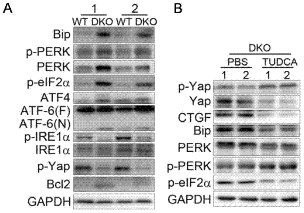 Pharmaceutical application of tauroursodeoxycholic acid and acceptable salts thereof