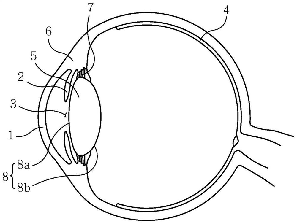 Intraocular lens