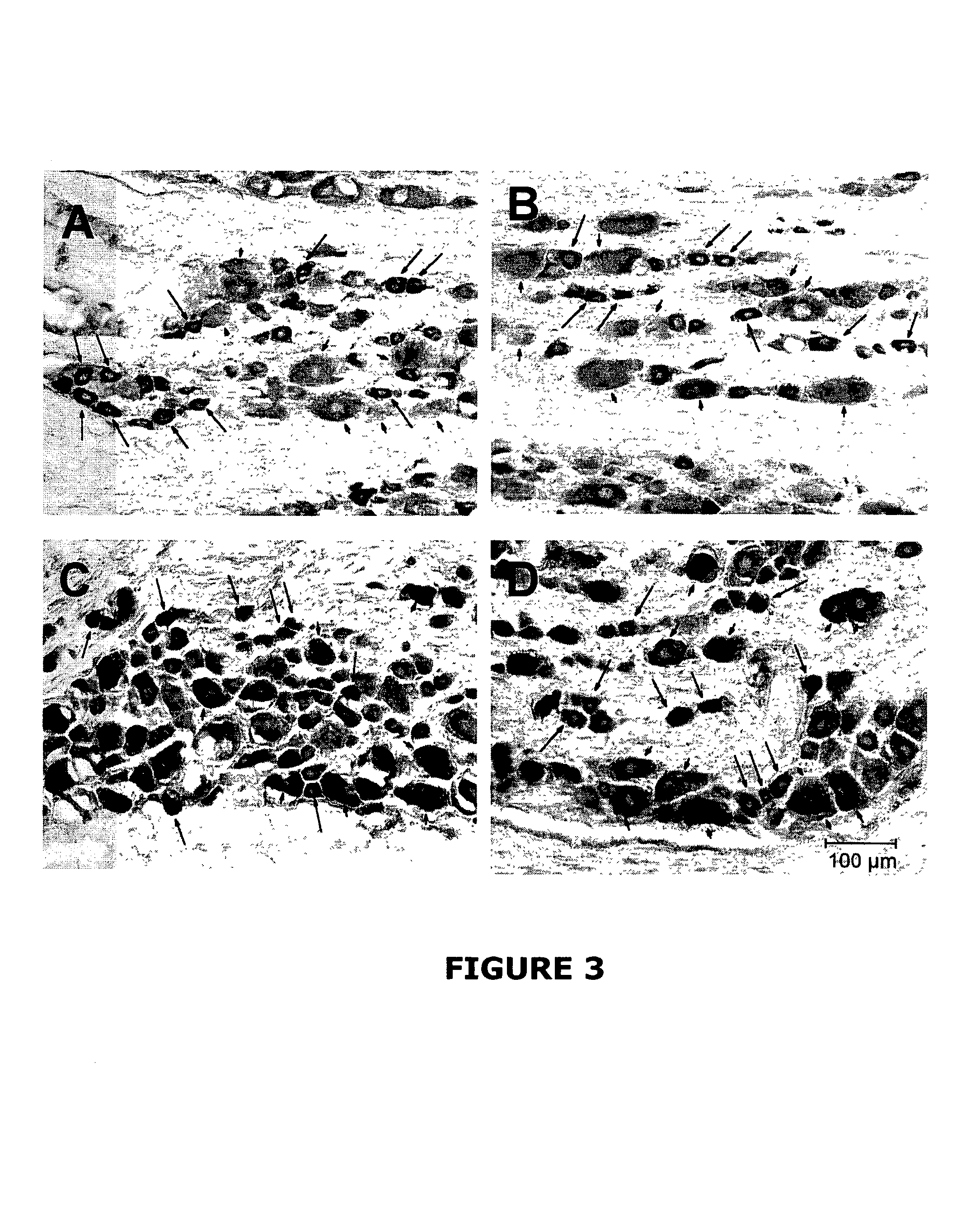 Method of alleviating chronic pain via peripheral glutaminase regulation