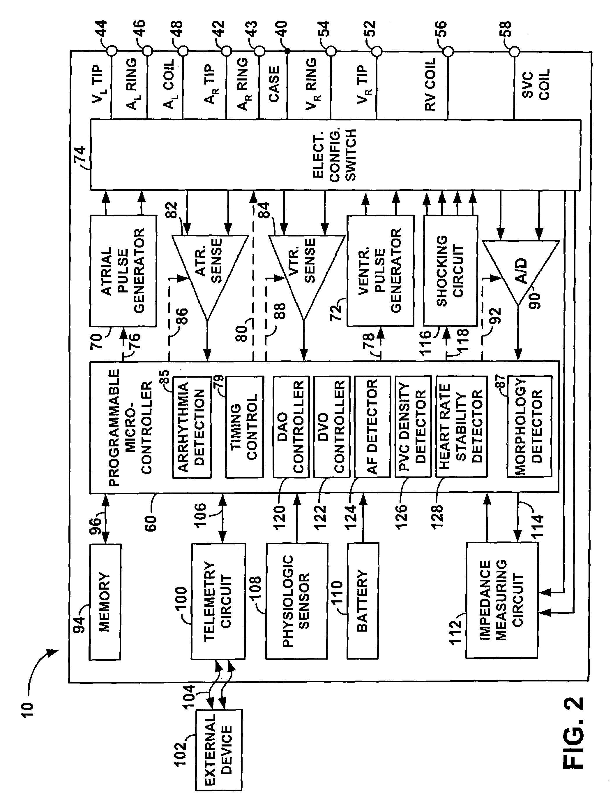 System and method for dynamic ventricular overdrive pacing