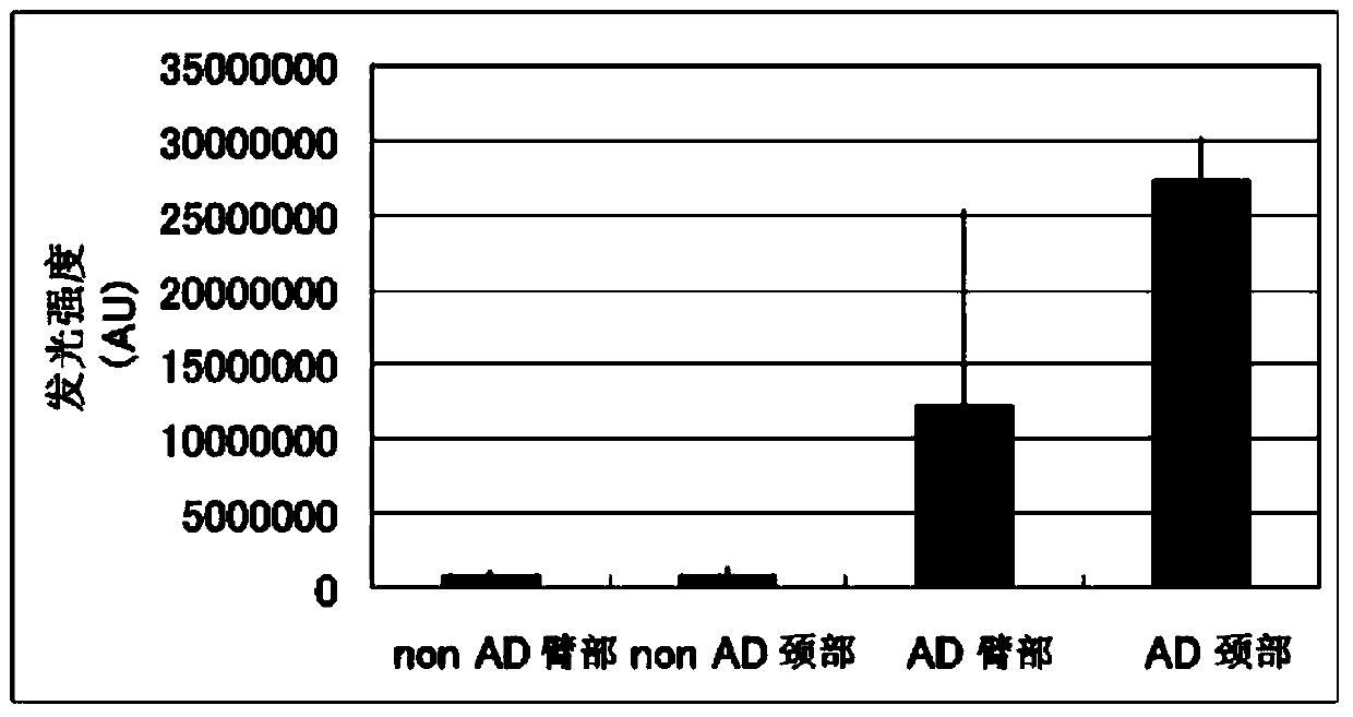 Method of evaluating degree of skin stress accumulation