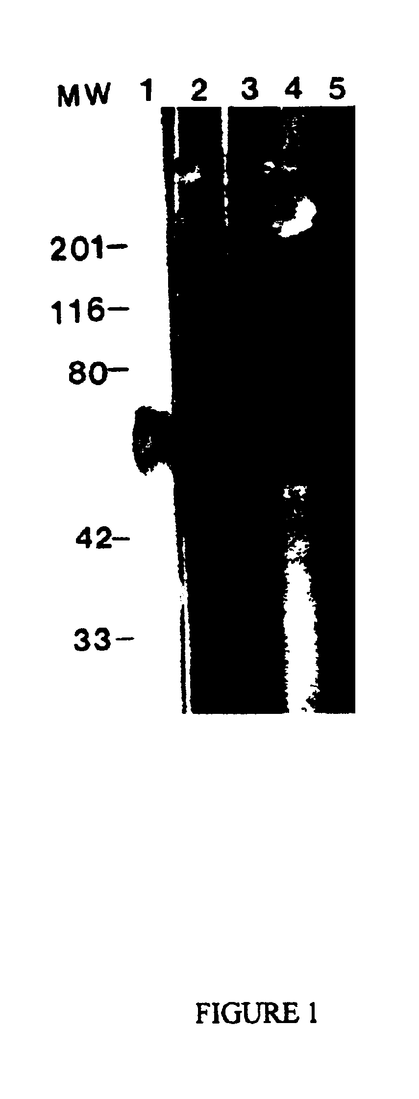 Purified antigen for Alzheimer's disease and methods of obtaining and using same