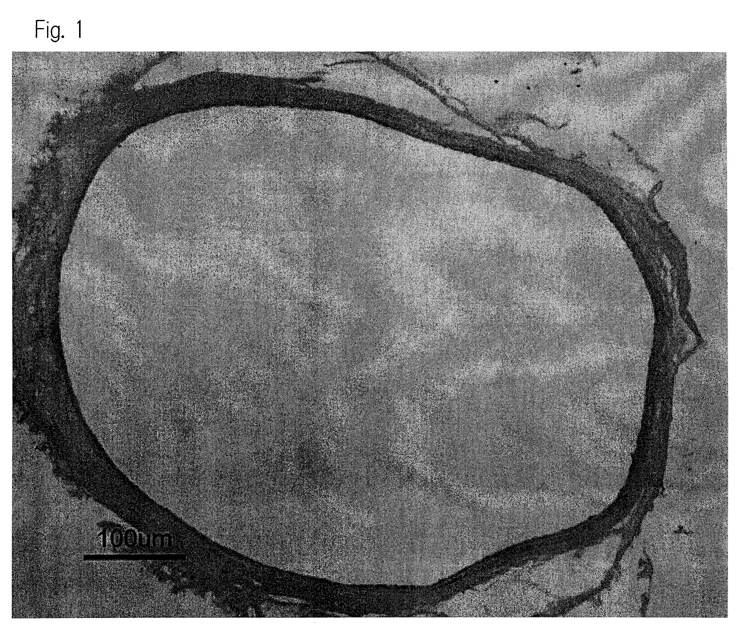 Therapeutic or prophylactic agent for vasoconstriction