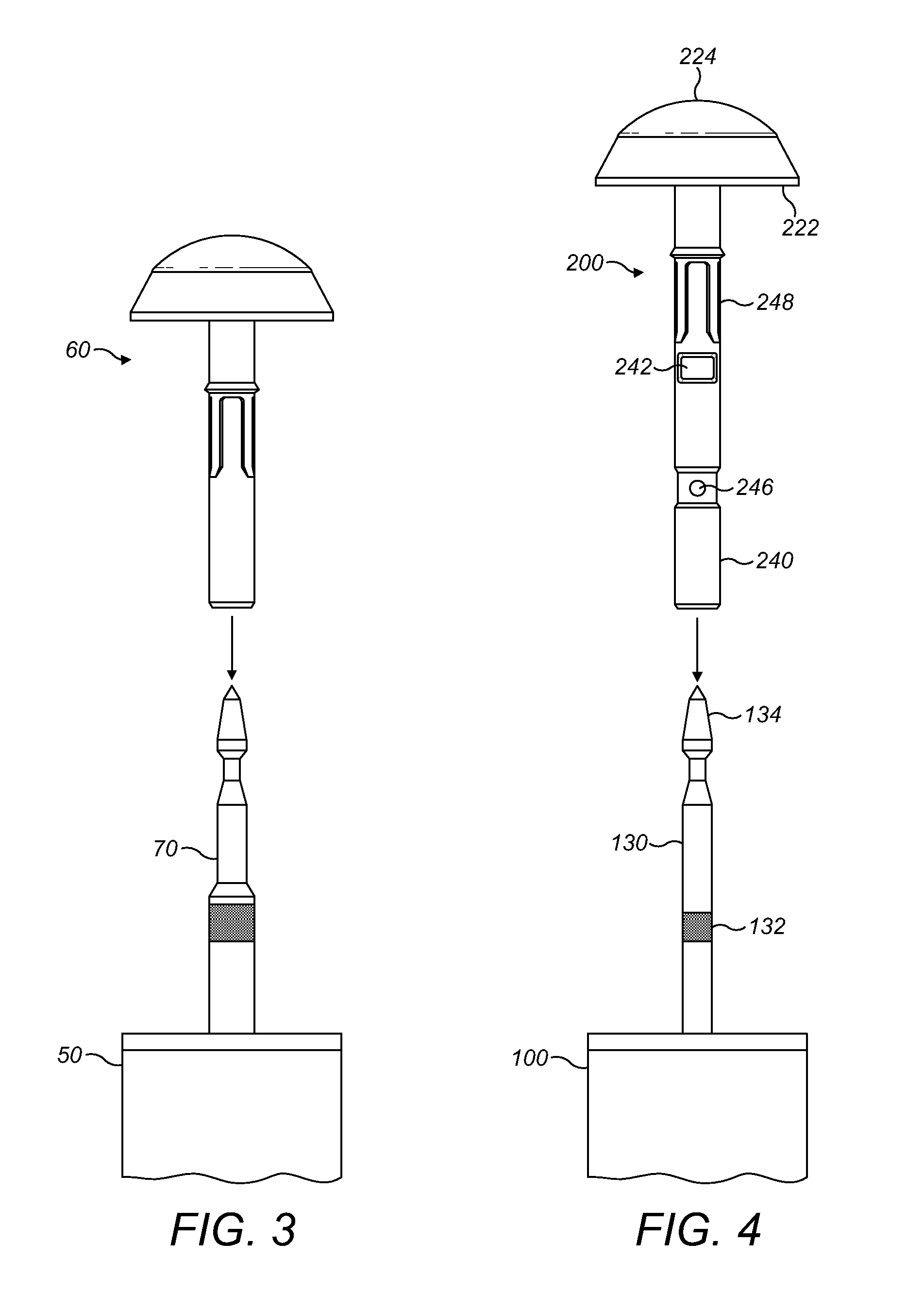 Method and apparatus for forming stoma trephines and anastomoses