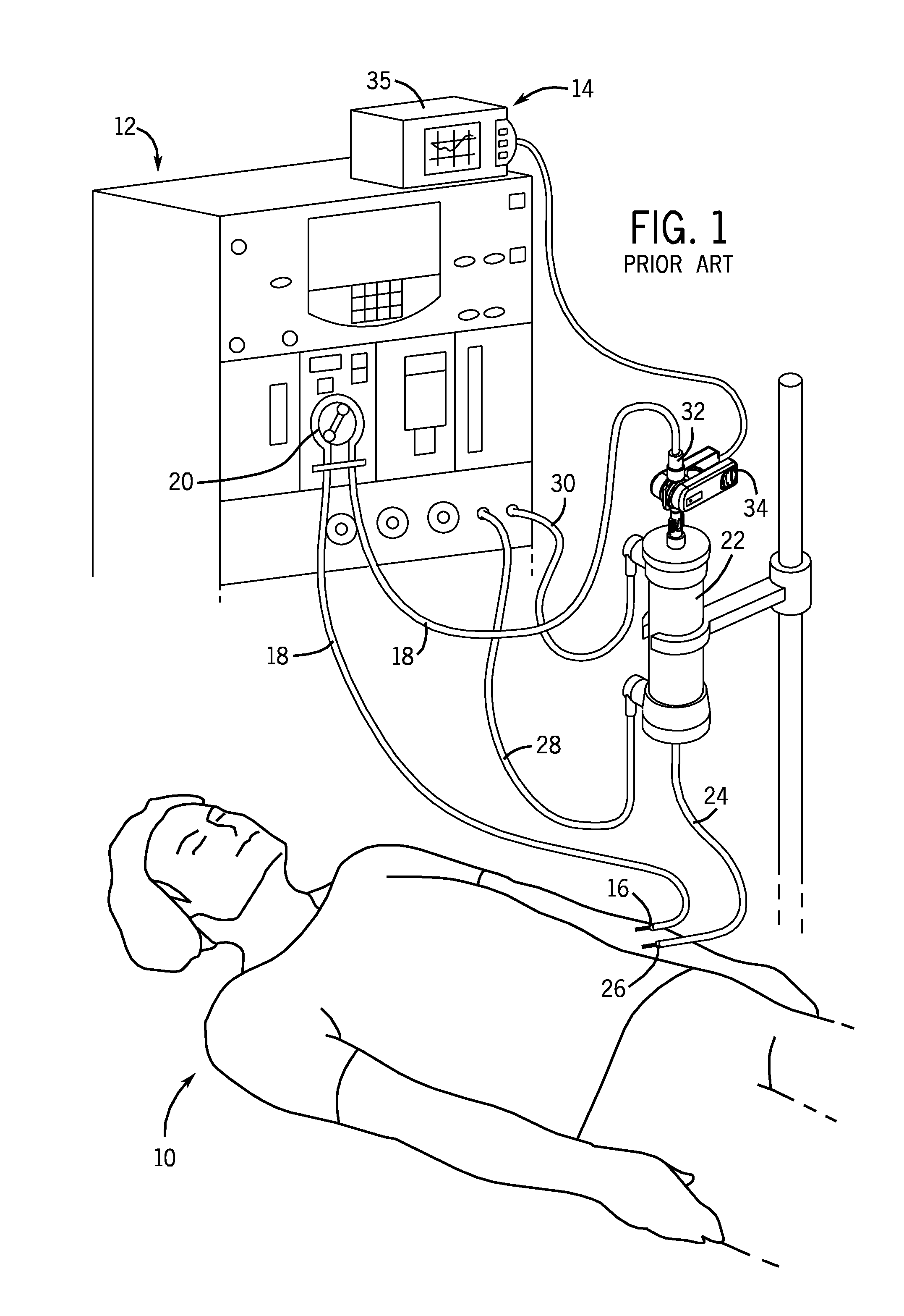 Off-Axis Blood Chamber