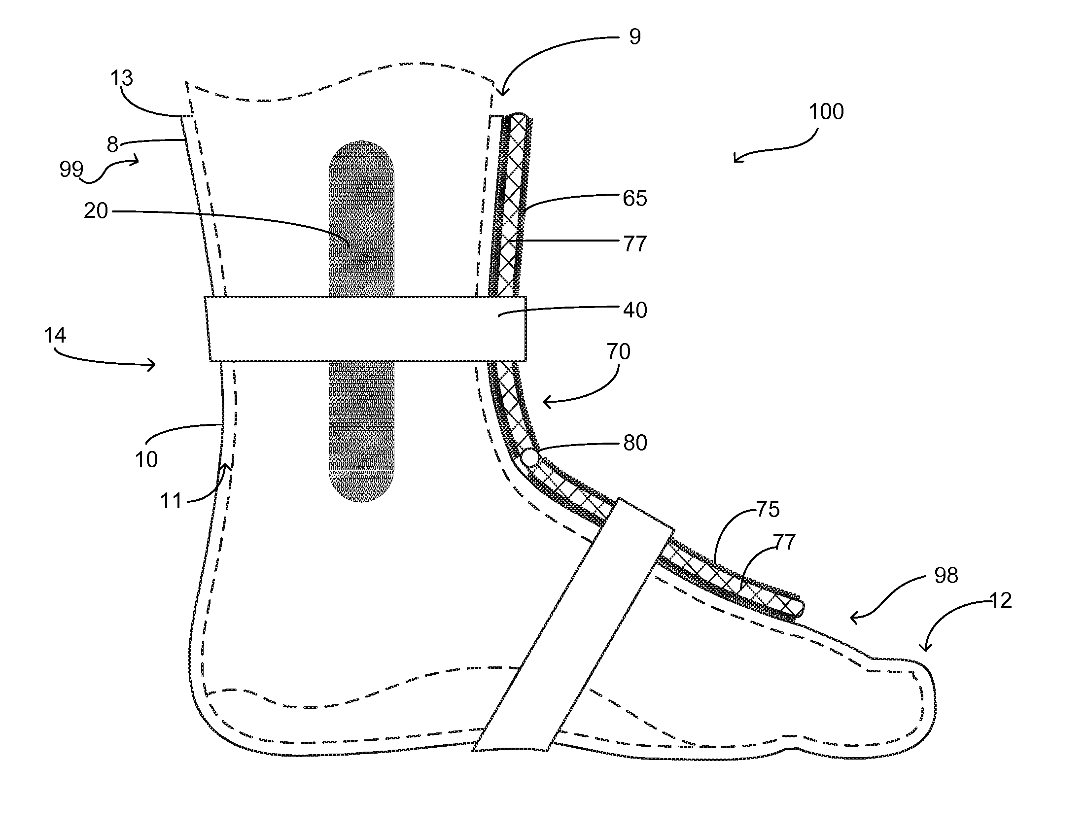 Foot pain treatment device and method of use