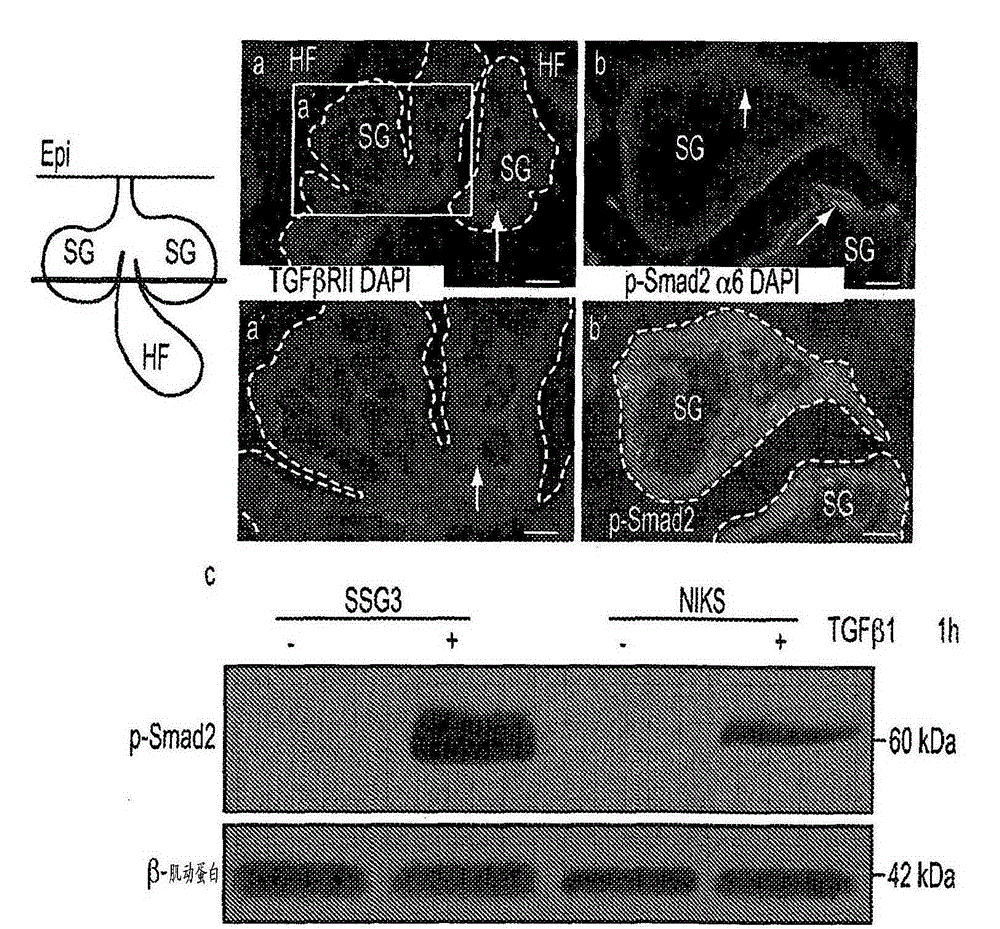 Sebocyte cell culturing and methods of use