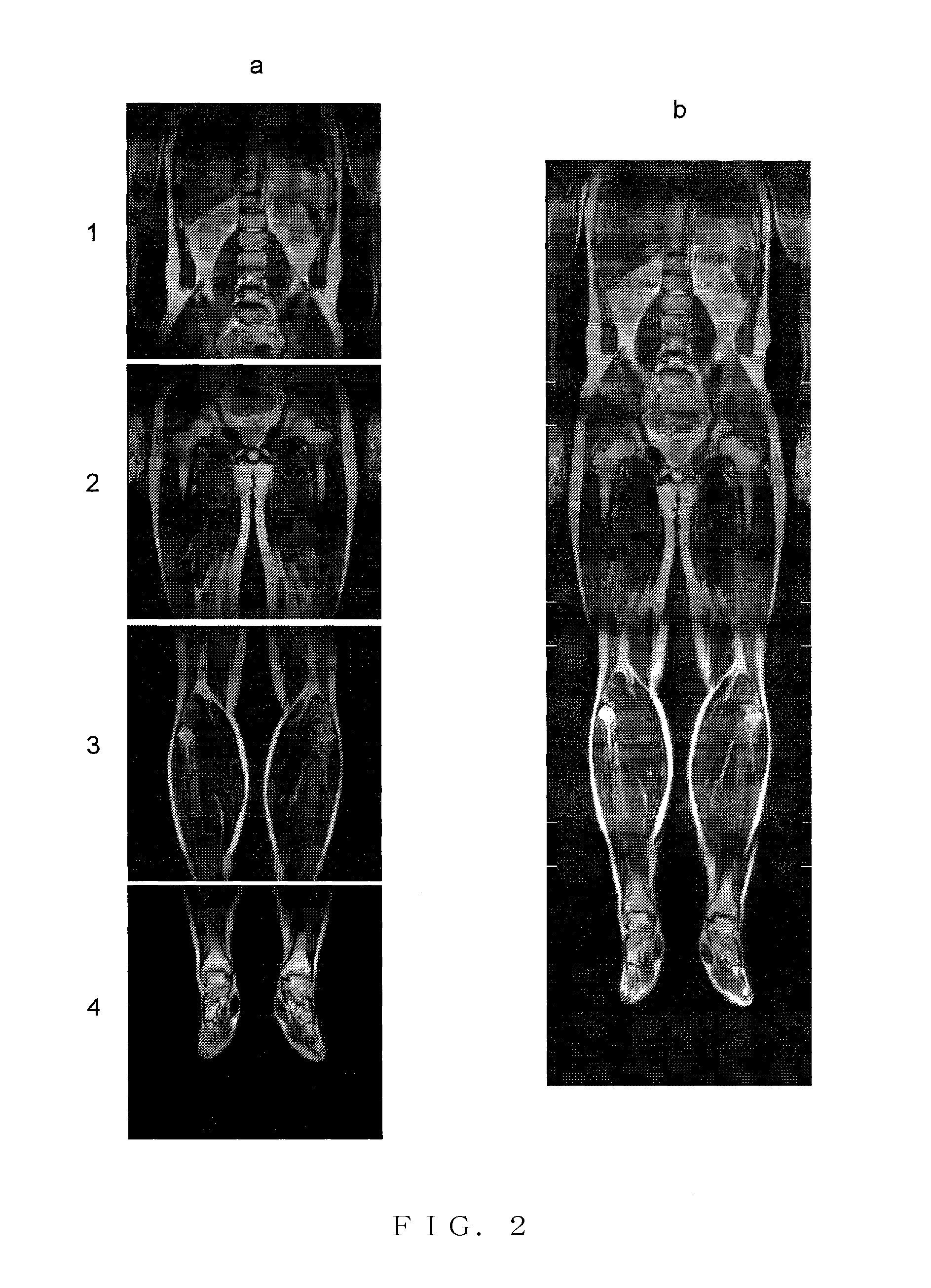 Magnetic resonance imaging device