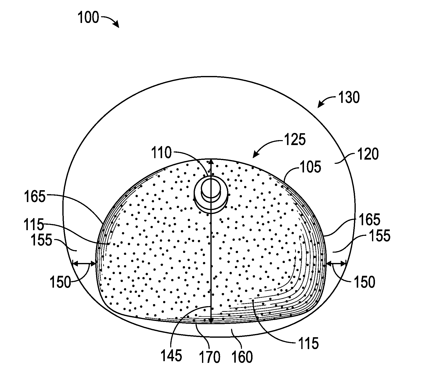 Systems and methods for a tissue expander