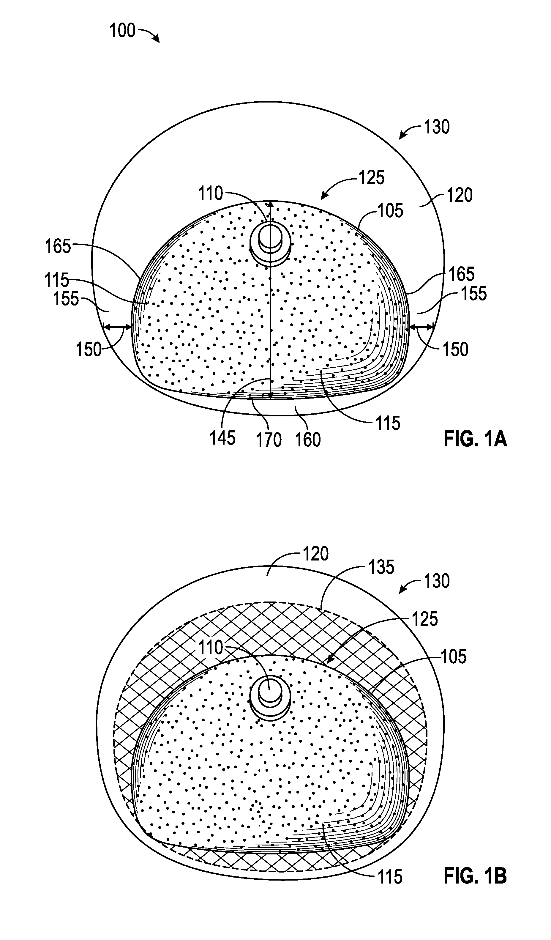 Systems and methods for a tissue expander