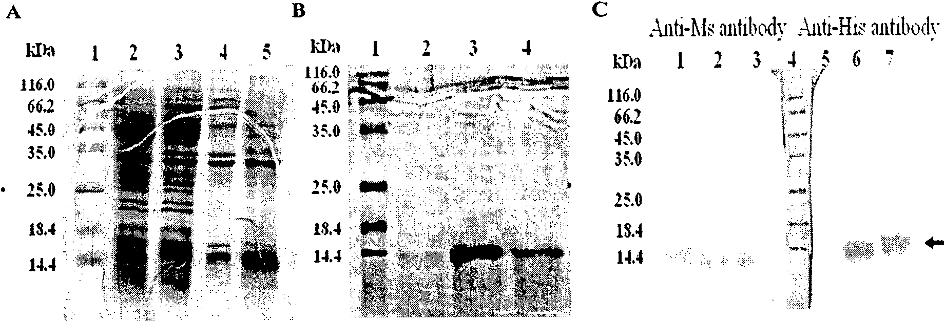 Therapeutic vaccine for Myostatin specific antibody and its preparation method