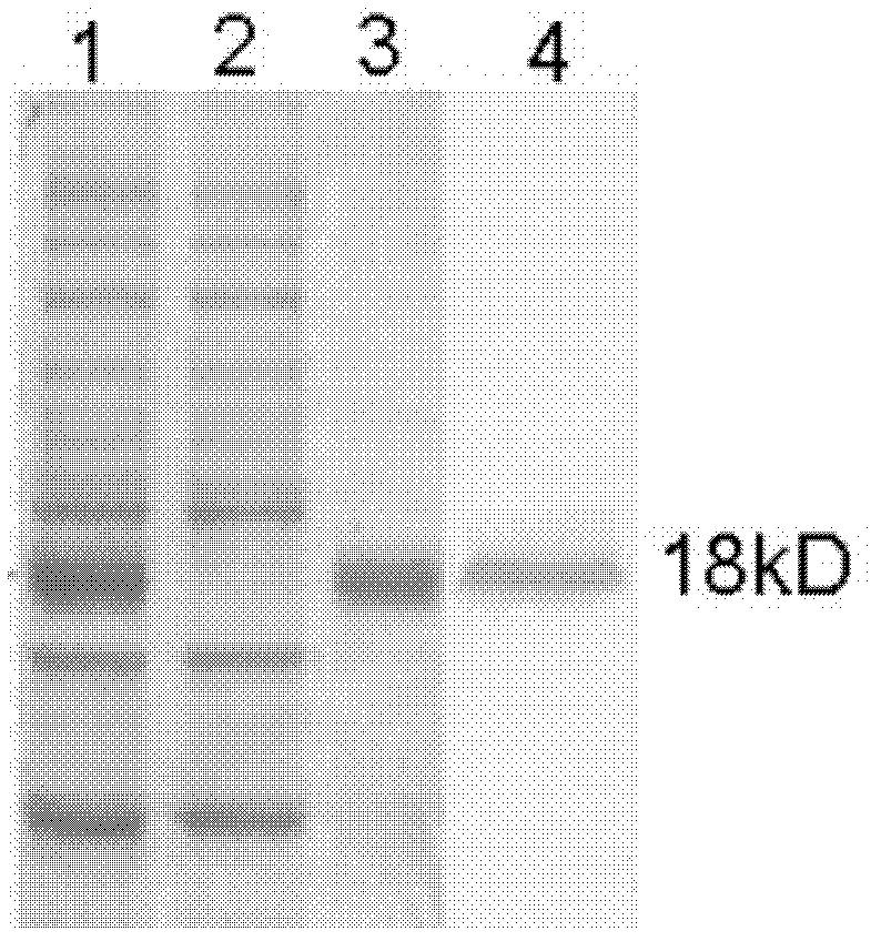 High throughput screening of important schistosoma japonicum antigens and application of antigens in schistosomiasis diagnosis