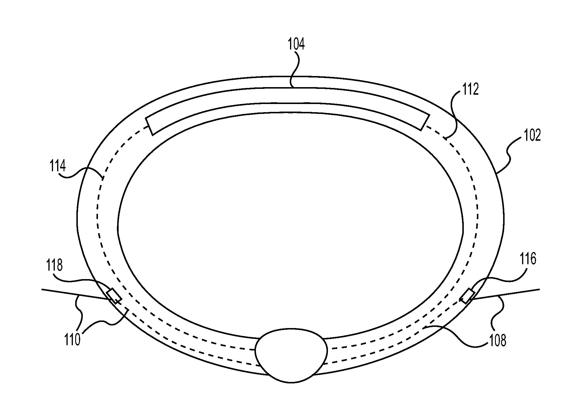 Devices and Methods for Treating a Heart