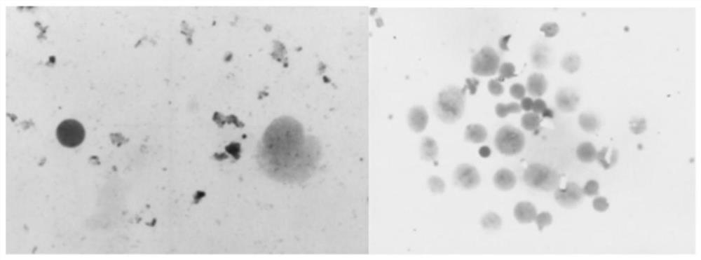 Pharmaceutical composition for treating COPD accompanied by pulmonary fibrosis