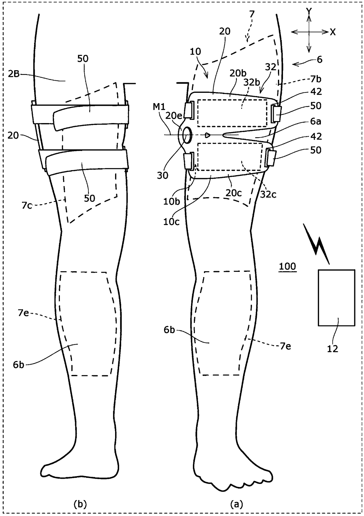 Muscle electrostimulation device