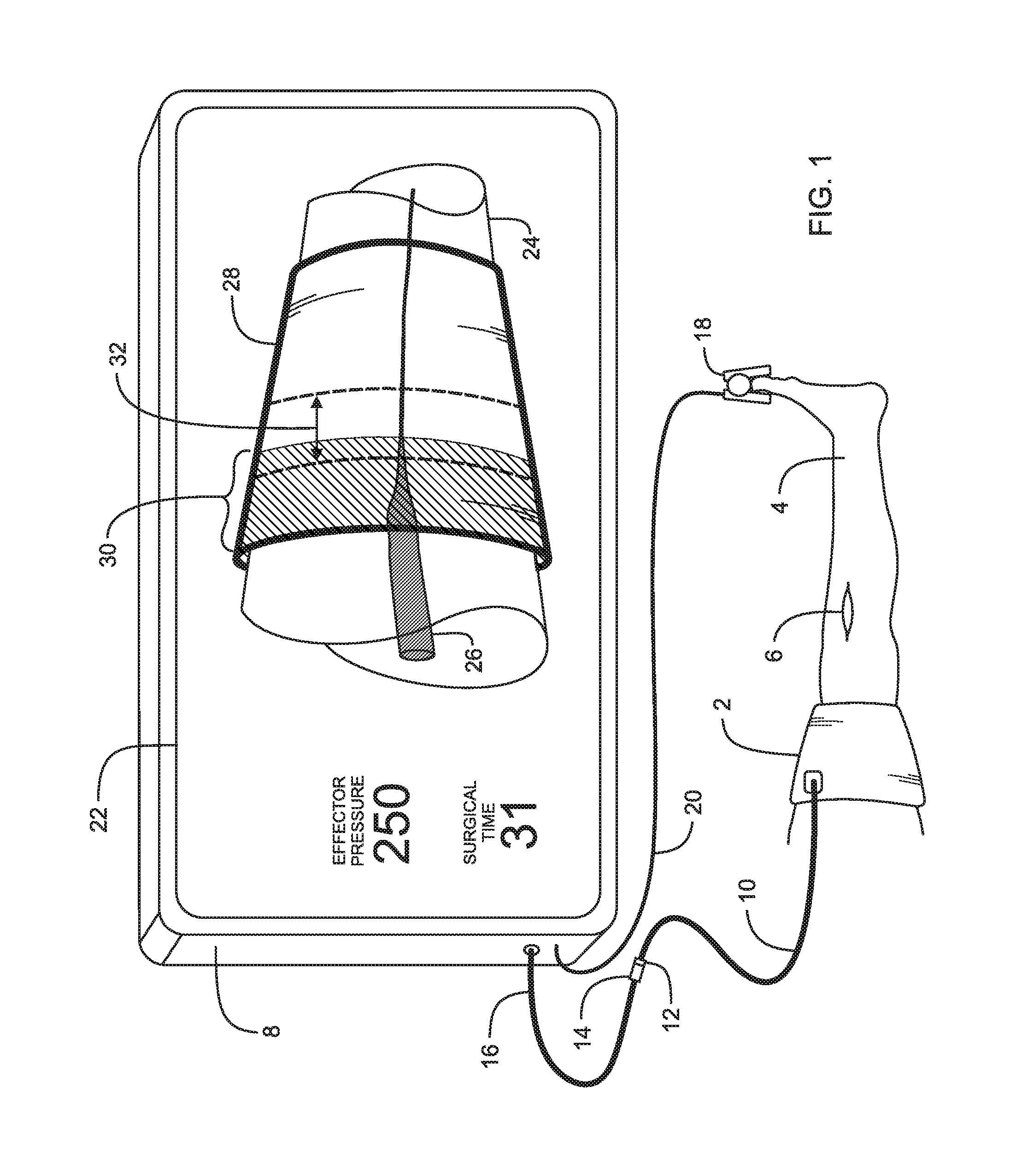 Personalized Tourniquet Apparatus