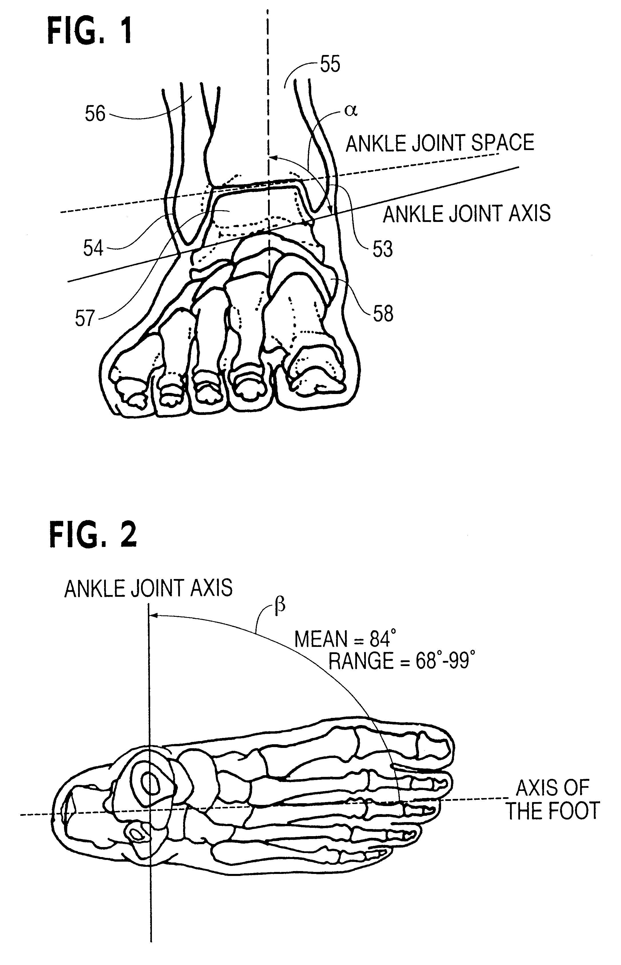 Shoe, ankle orthosis and method for protecting the ankle