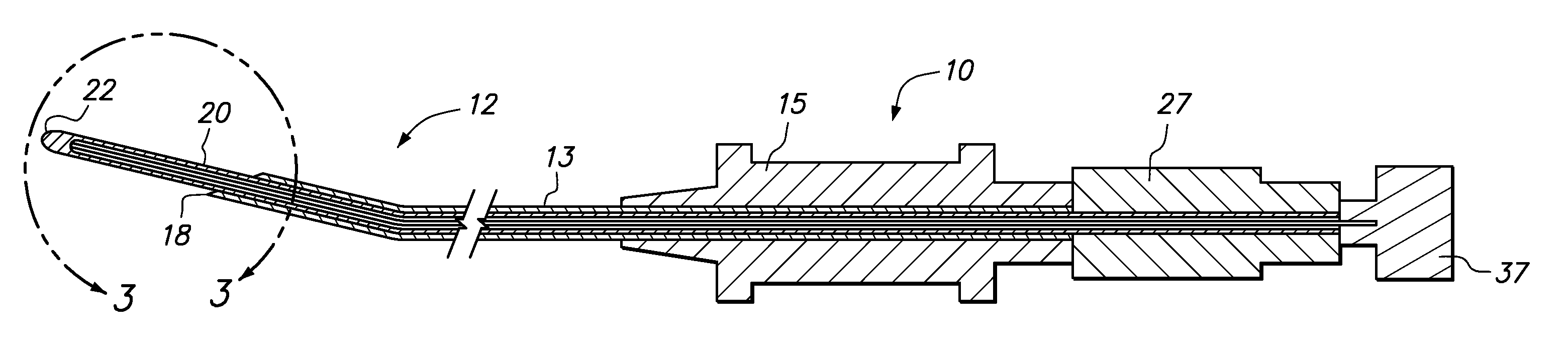 Epidural radiofrequency catheter for effectuating RF treatment in spinal canal and method of using same