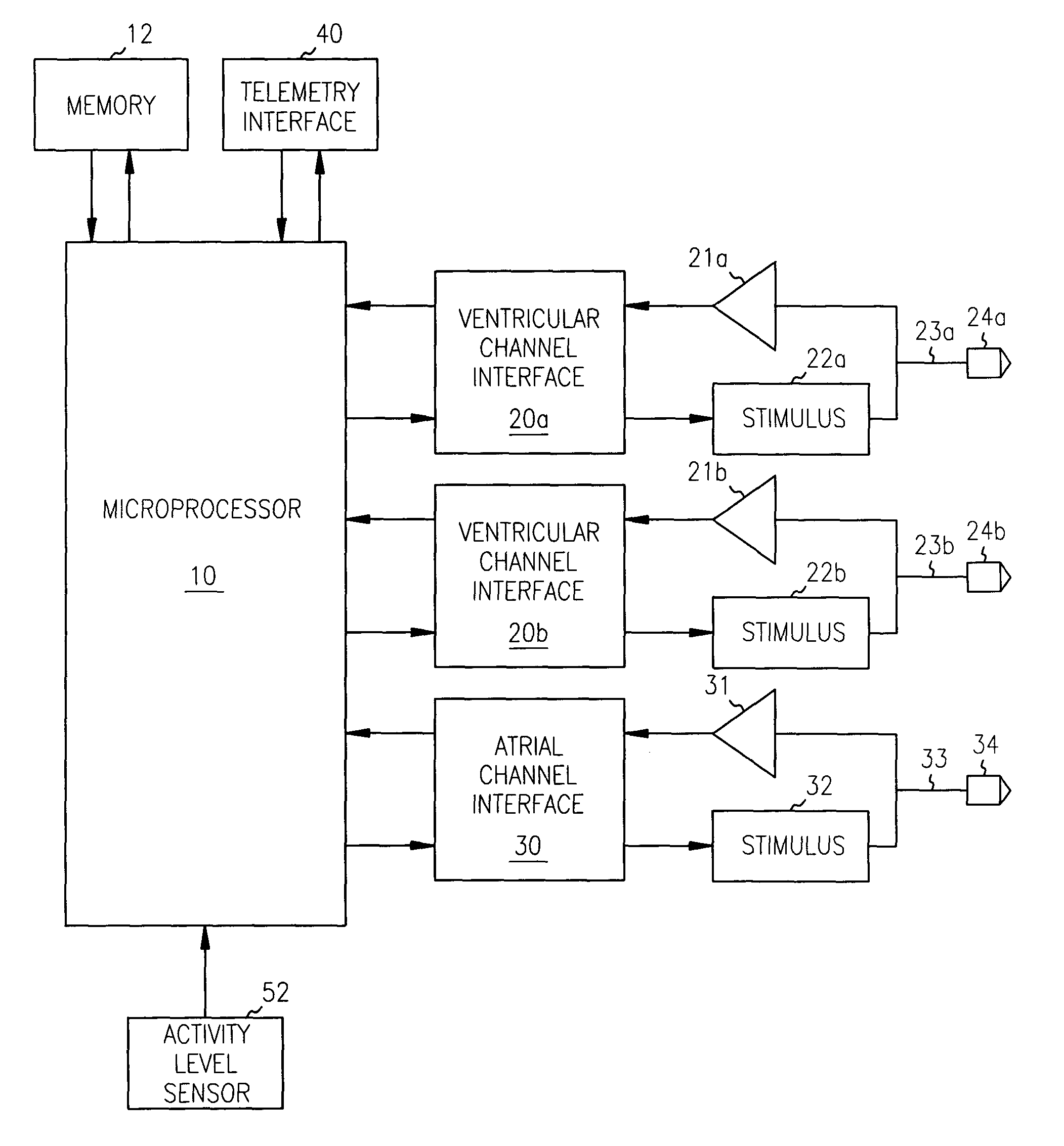 Apparatus and method for reversal of myocardial remodeling with electrical stimulation