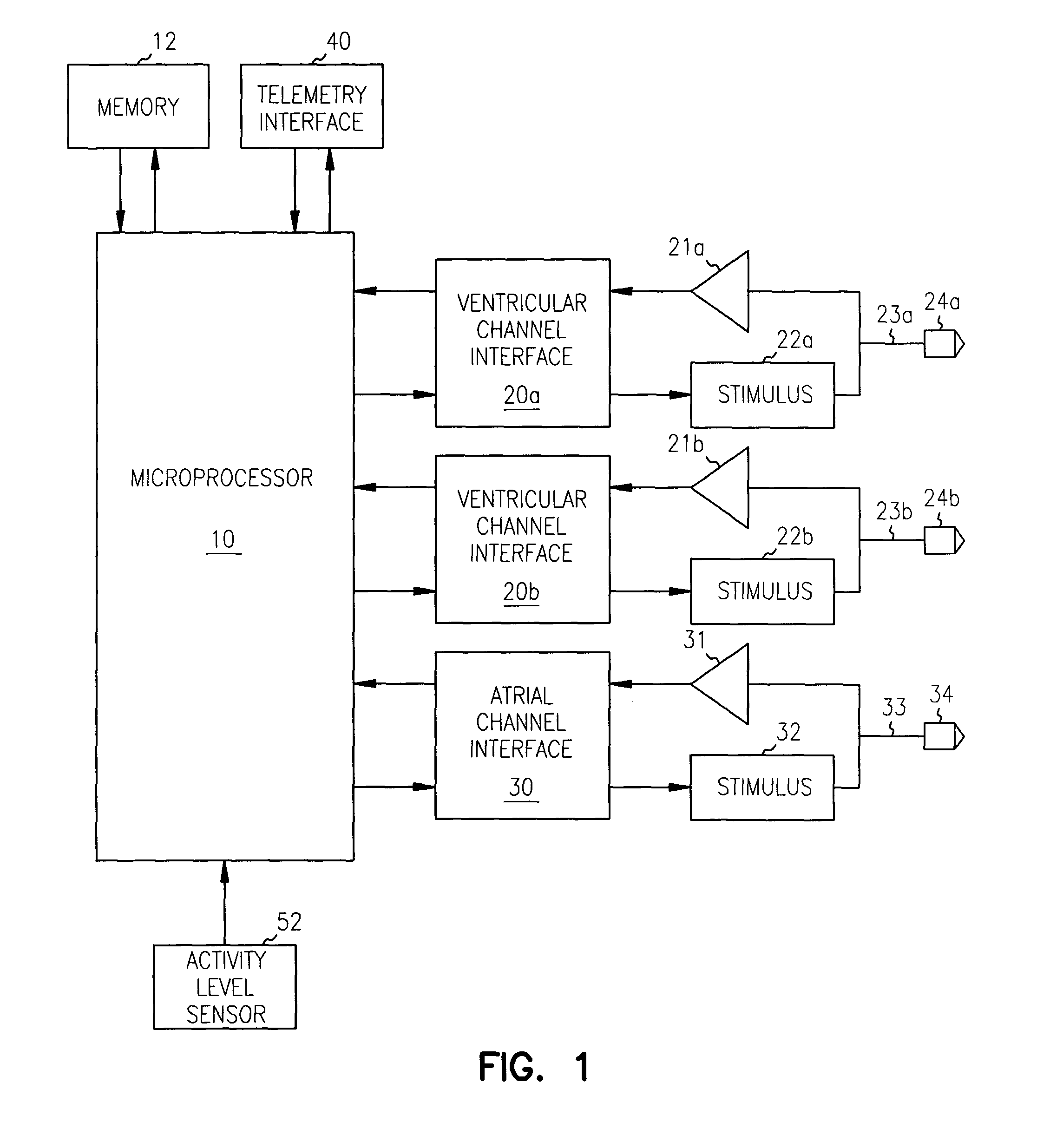 Apparatus and method for reversal of myocardial remodeling with electrical stimulation