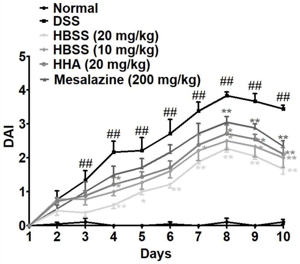 Application of sodium p-hydroxybenzoate in preparation of medicine for treating or preventing inflammatory bowel diseases