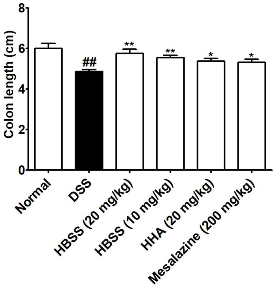 Application of sodium p-hydroxybenzoate in preparation of medicine for treating or preventing inflammatory bowel diseases