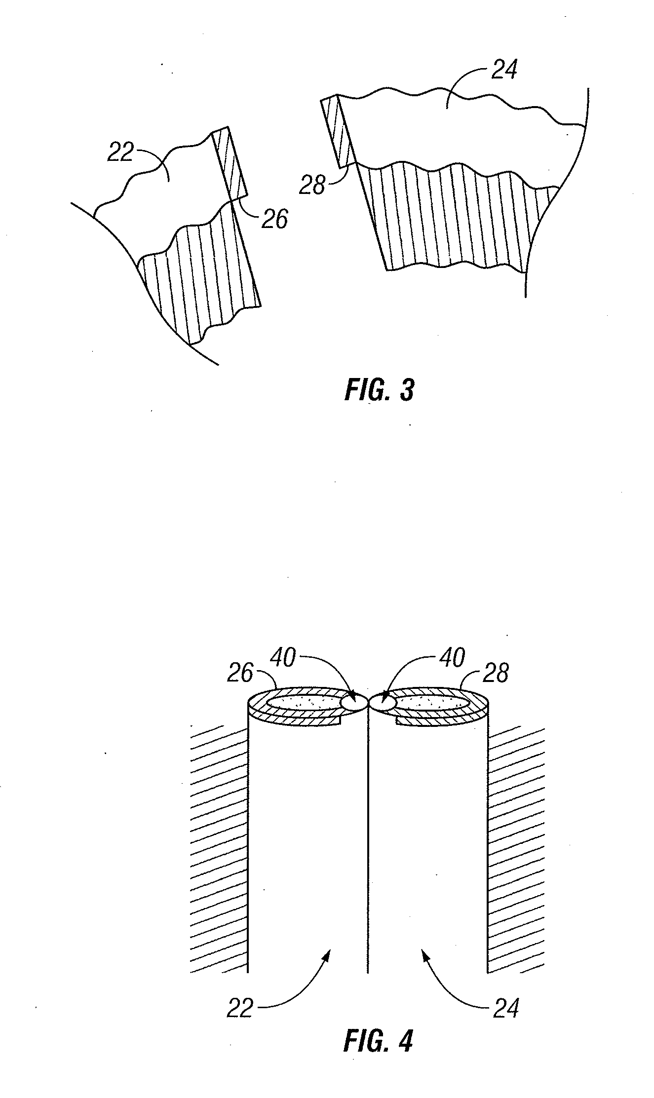 Method and Apparatus for RF Anastomosis