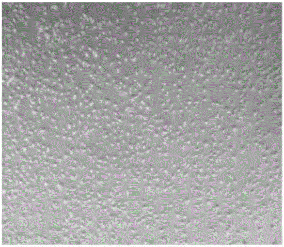 Bletilla striata polysaccharide hydrogel, culture medium and application thereof as well as method of inducing differentiation of umbilical cord mesenchymal stem cells to corneal epithelial cells