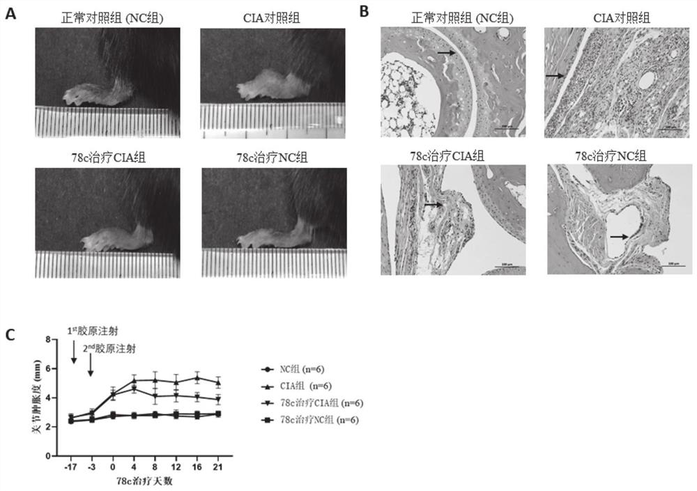 Use of 78c or pharmaceutical composition thereof in preparing anti-rheumatoid arthritis product