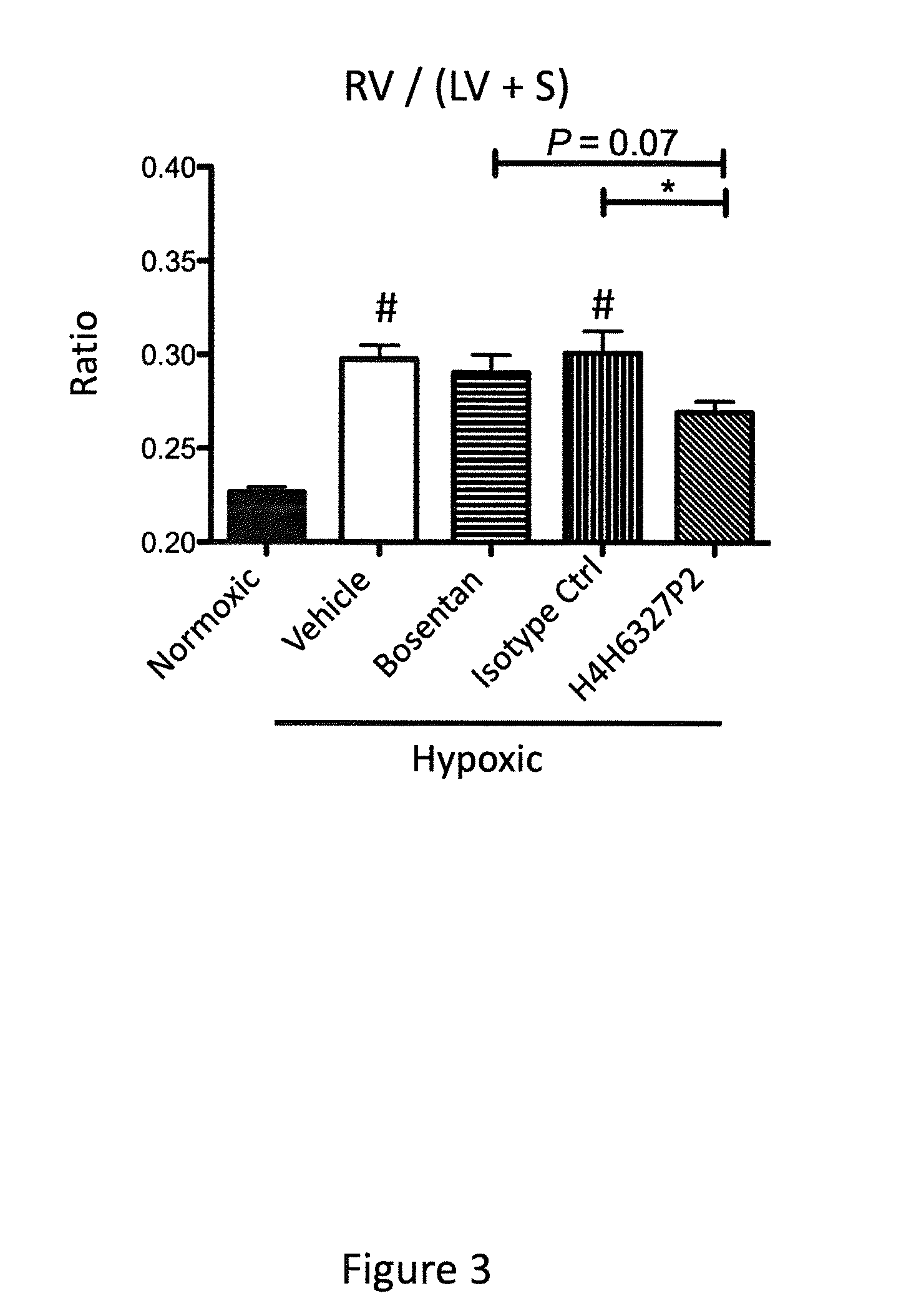 Anti-big-endothelin-1 (big-et-1) antibodies and uses thereof