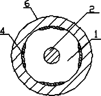 Coracoclavicular ligament fixing device for acromioclavicular dislocation