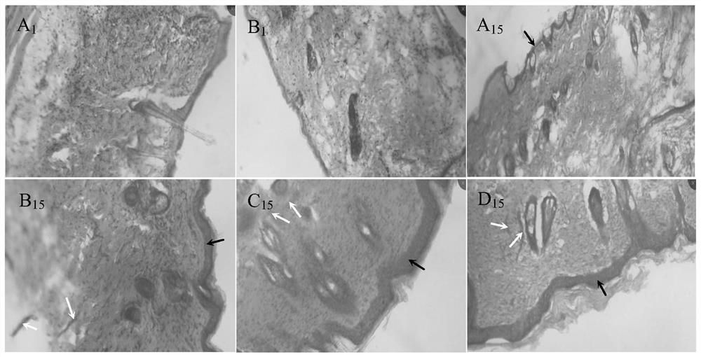 Application of fomes fomentarius exopolysaccharide