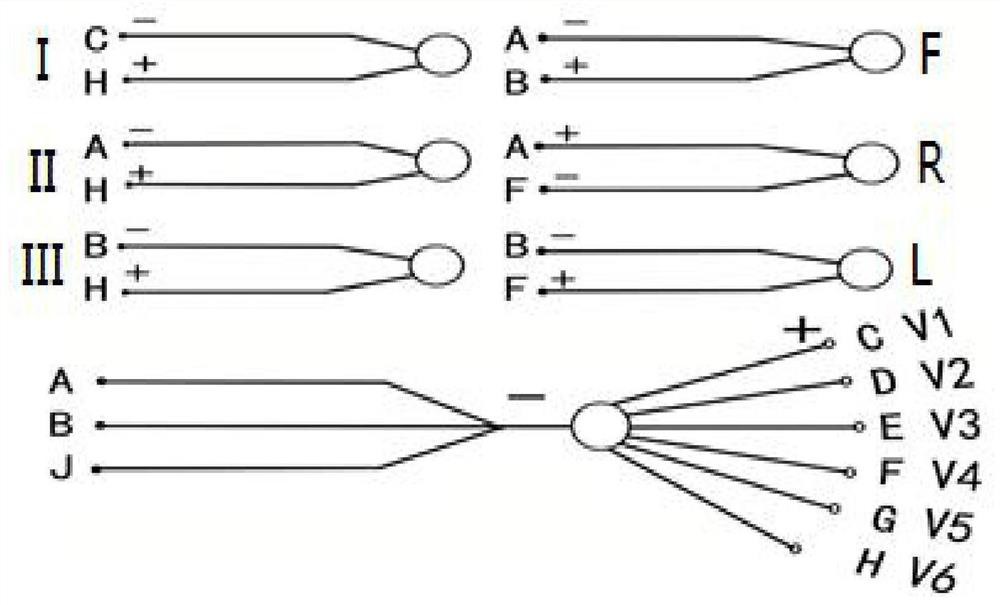 Novel 12-lead system easy for computer electrocardiosignal feature recognition