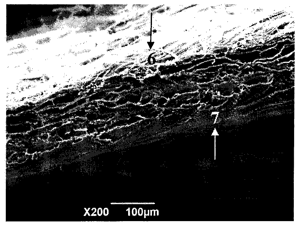 Preparation method and device of duramater/spinal dural transplanting substitute