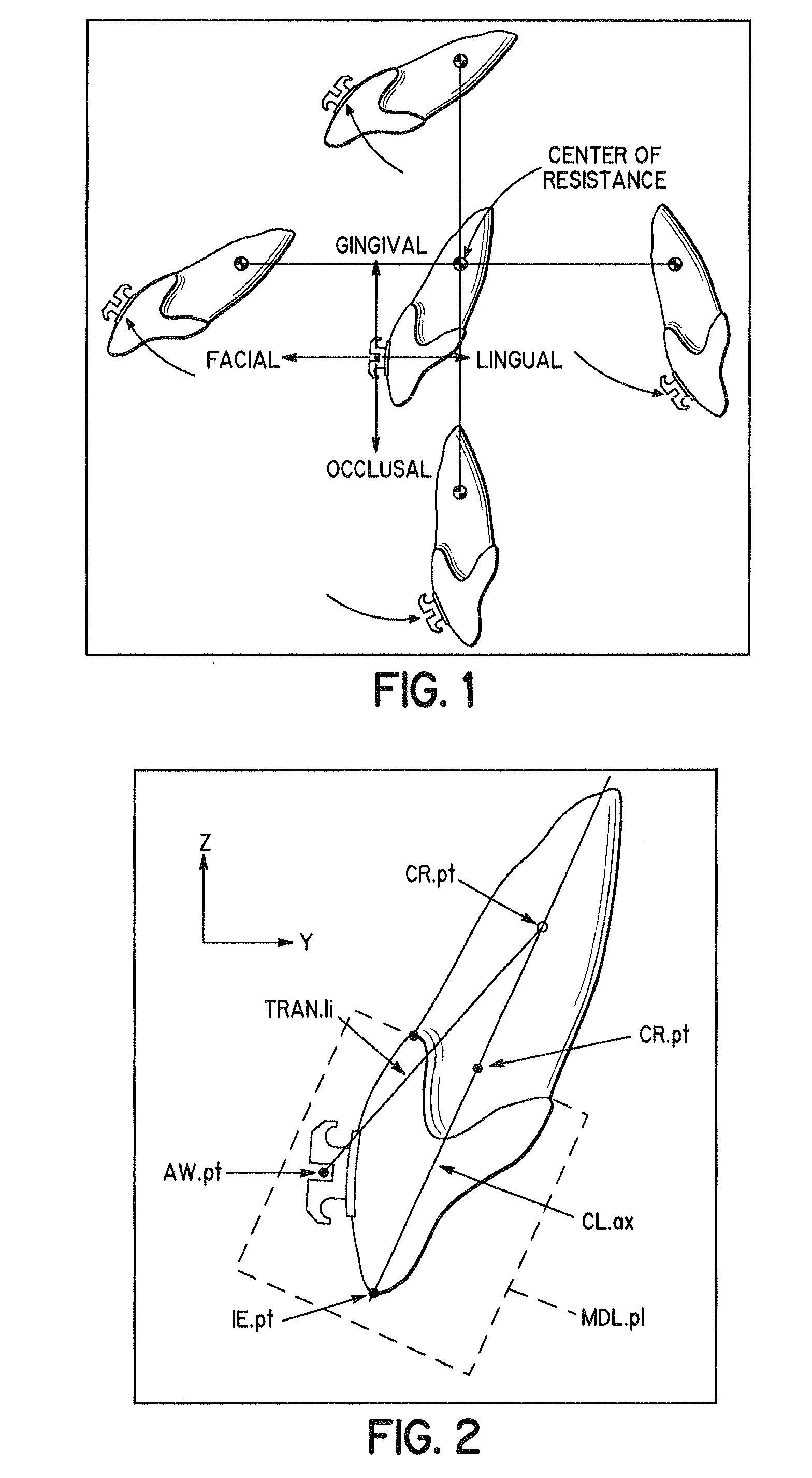 Torque Overcorrection Model