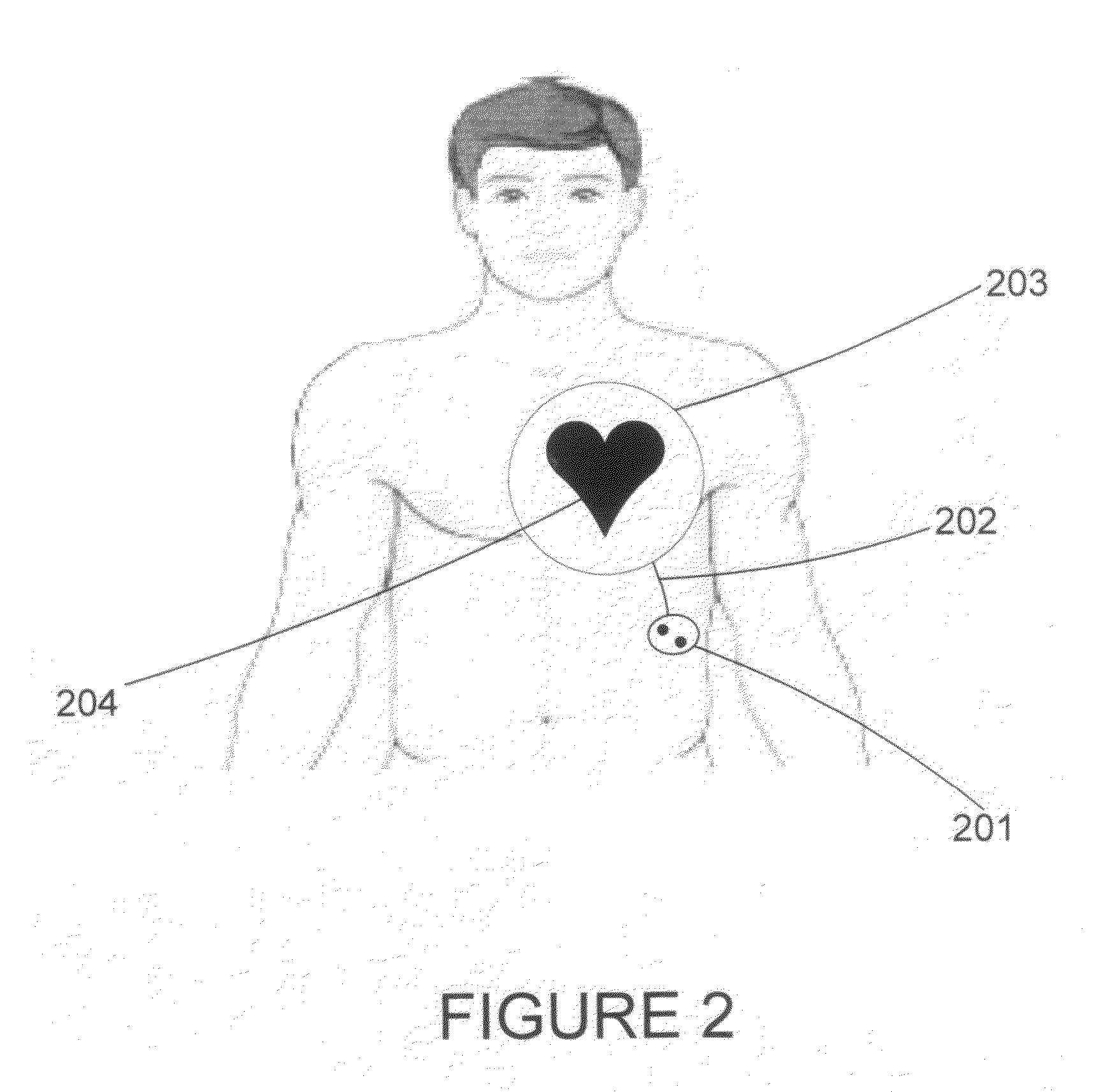 Electromagnetic treatment apparatus and metod for angiogensis modulation of living tissues and cells