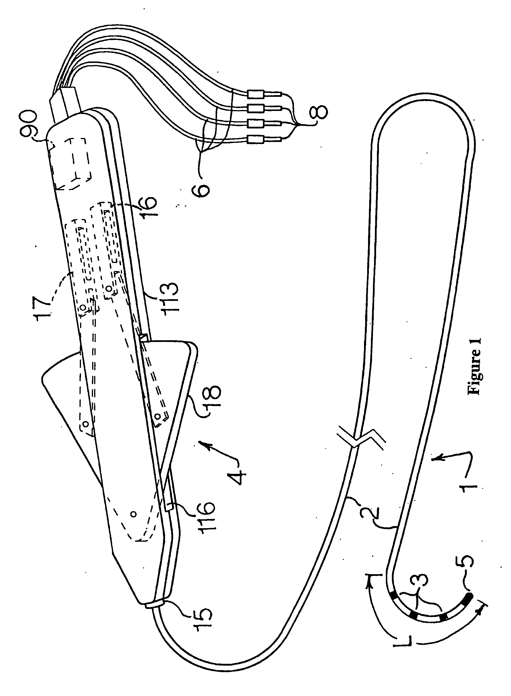 Electrophysiology/ablation catheter and remote actuator therefor