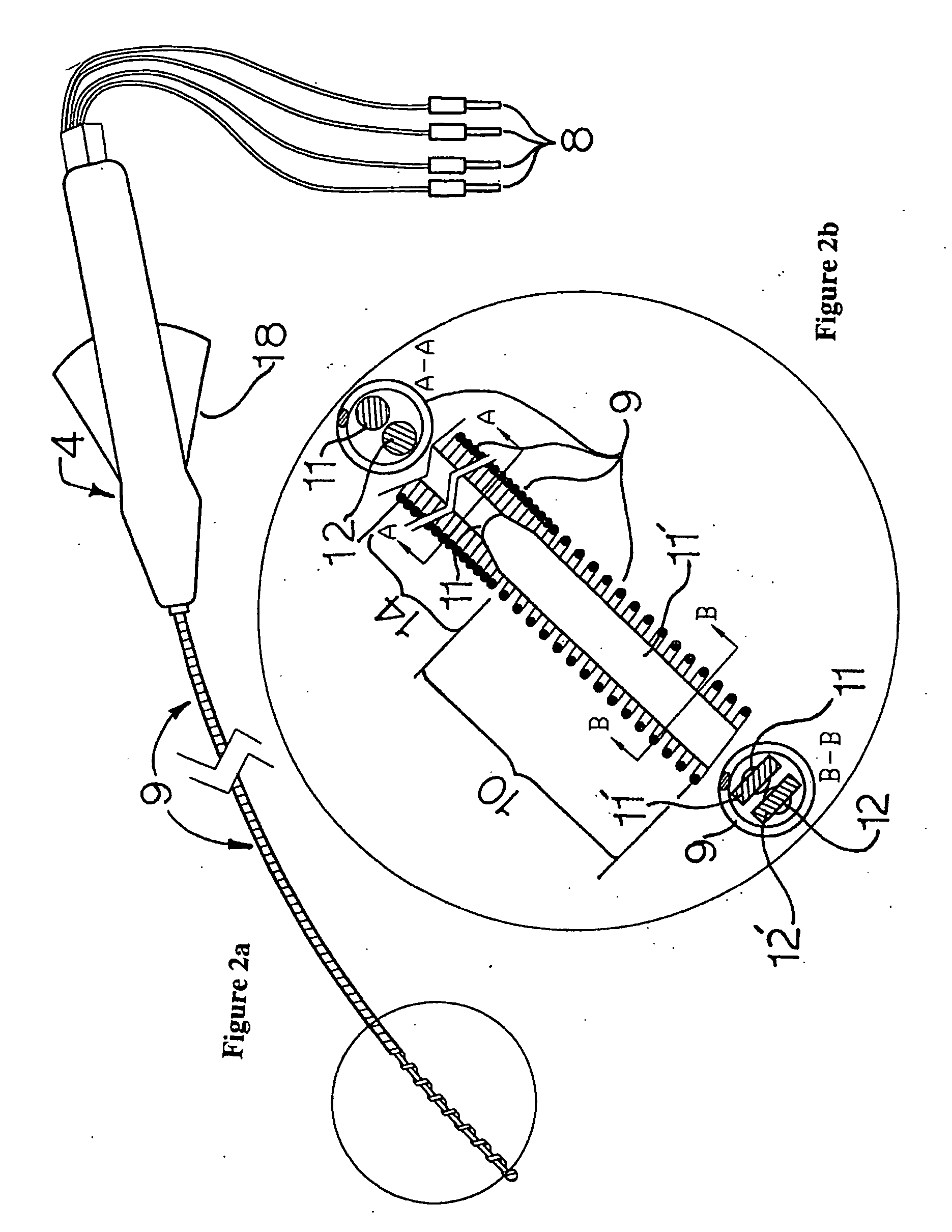 Electrophysiology/ablation catheter and remote actuator therefor