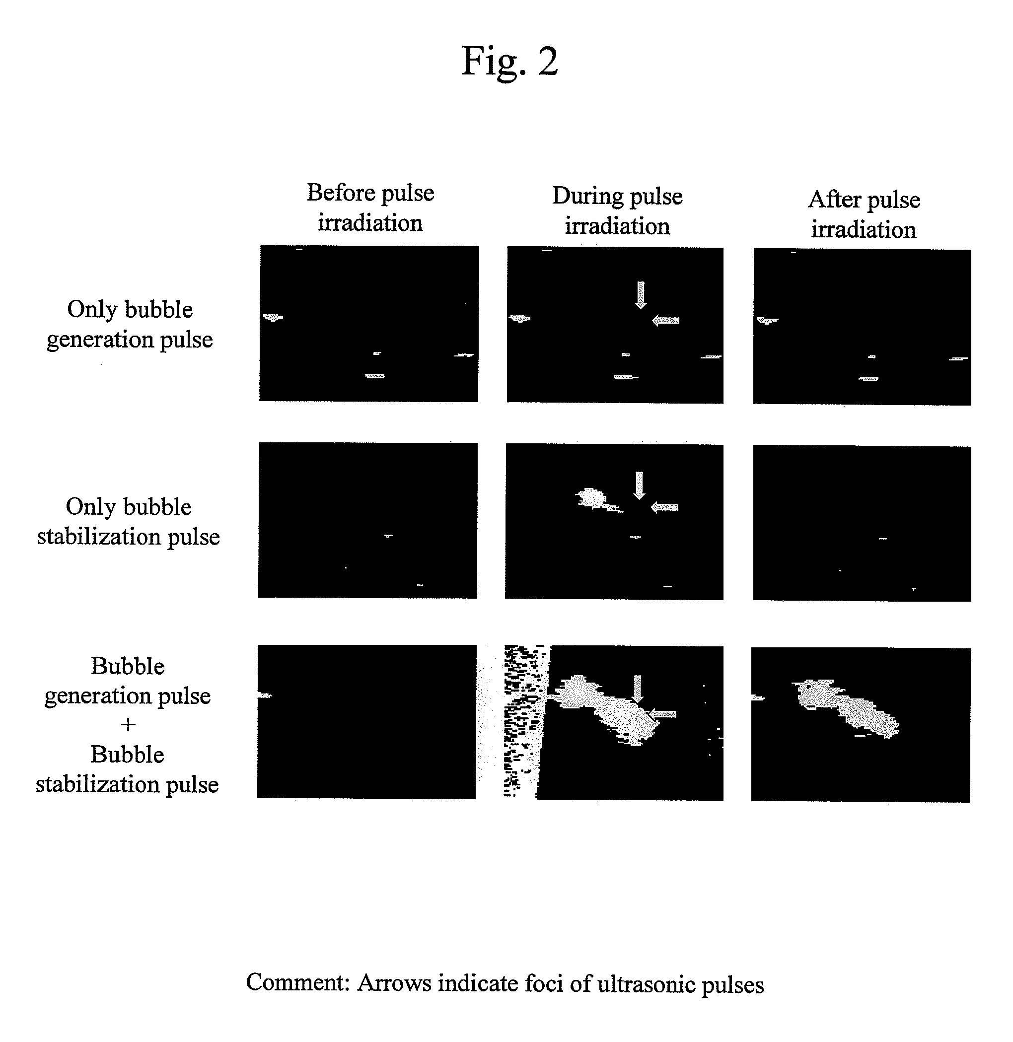 Ultrasonic treatment device