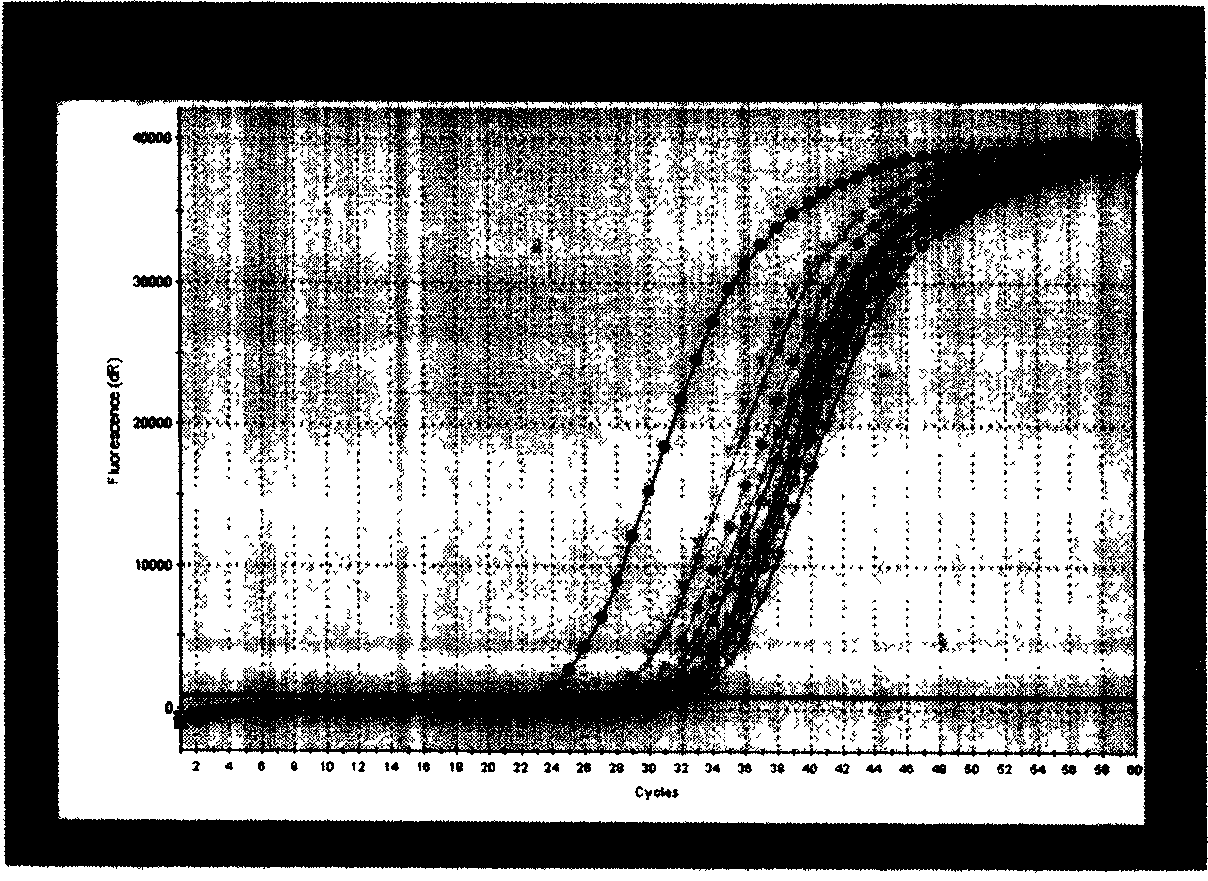 Process for extracting free mRNA from pleural fluid and ascitic fluid