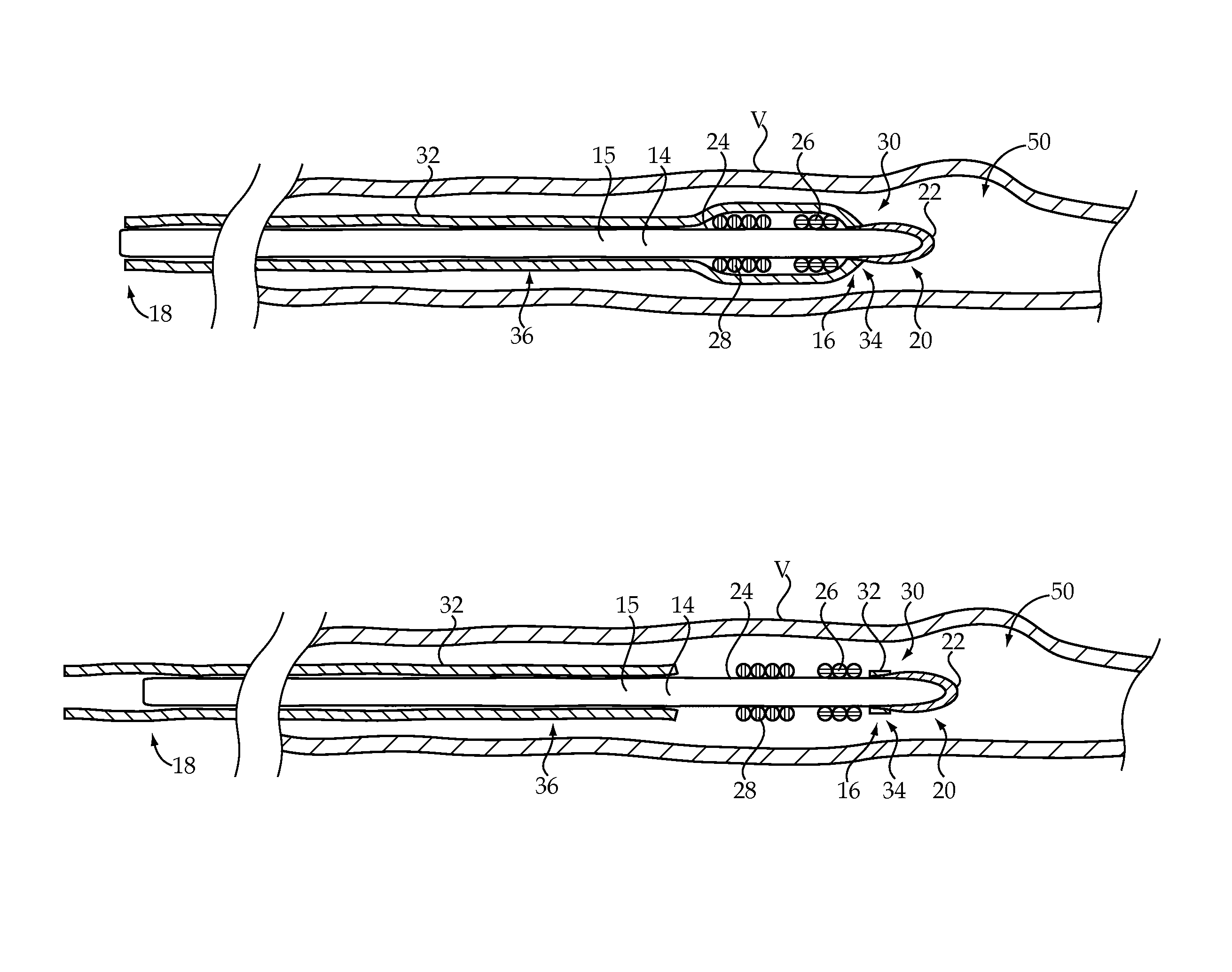 Embolic coil delivery system