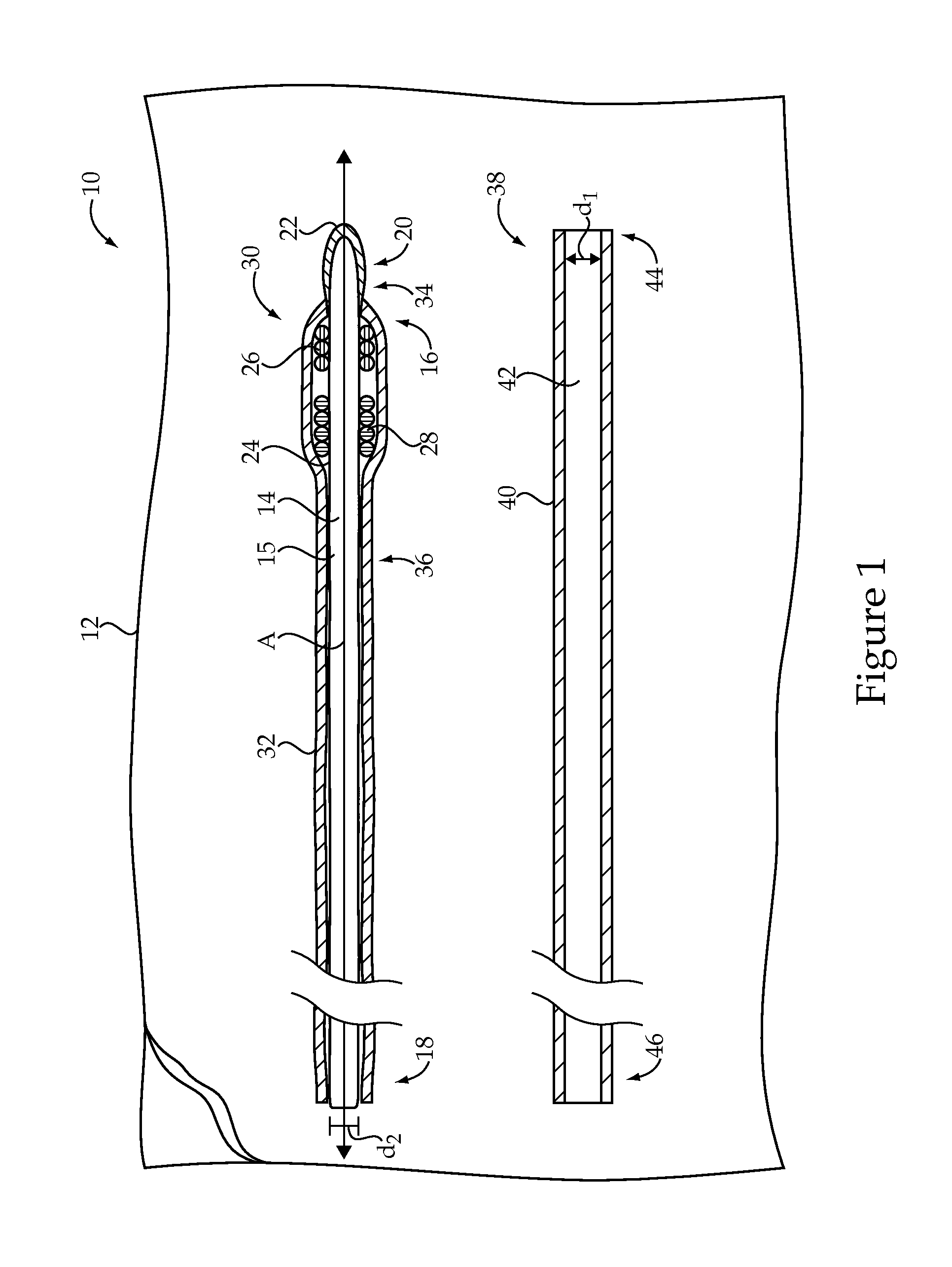 Embolic coil delivery system