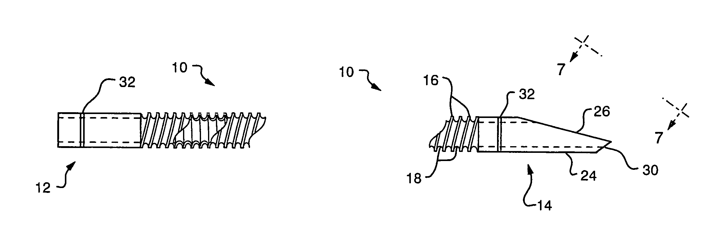 Stent delivery catheter