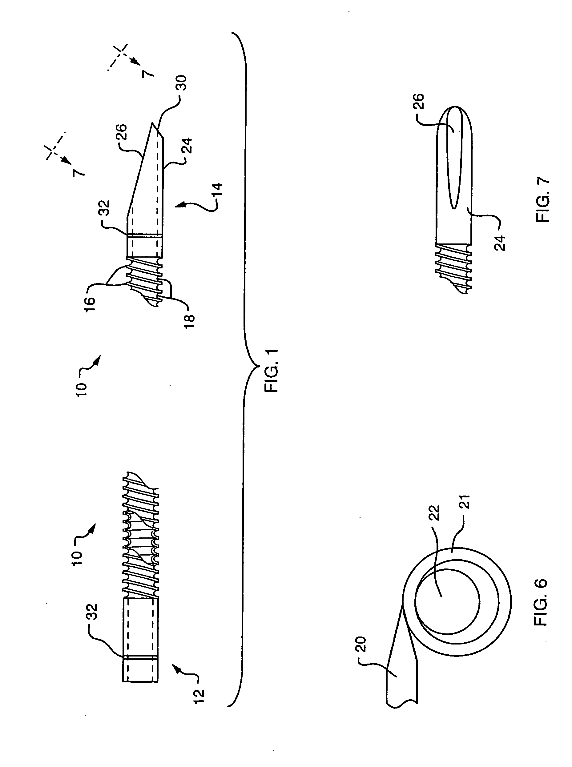 Stent delivery catheter