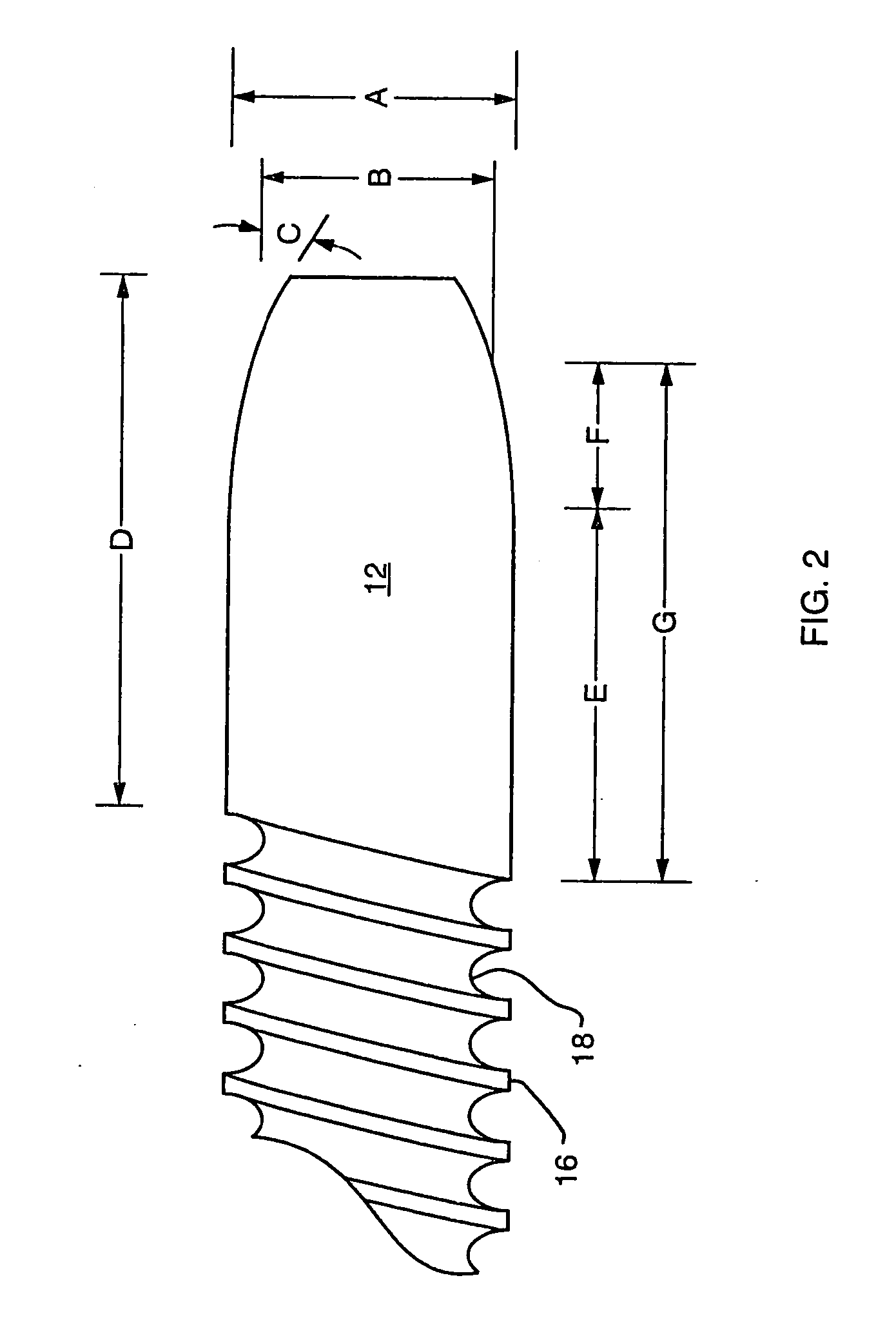 Stent delivery catheter